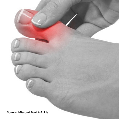 a person holding his/her toe because of pain