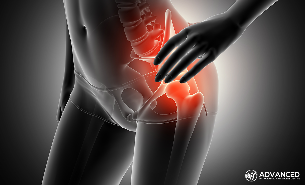 A skeleteal image of a hip joint with a red highlight