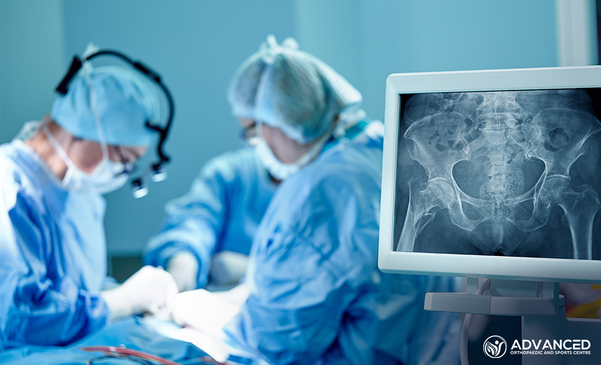 What You Need To Know About New Advances In Hip & Knee Replacement Surgery