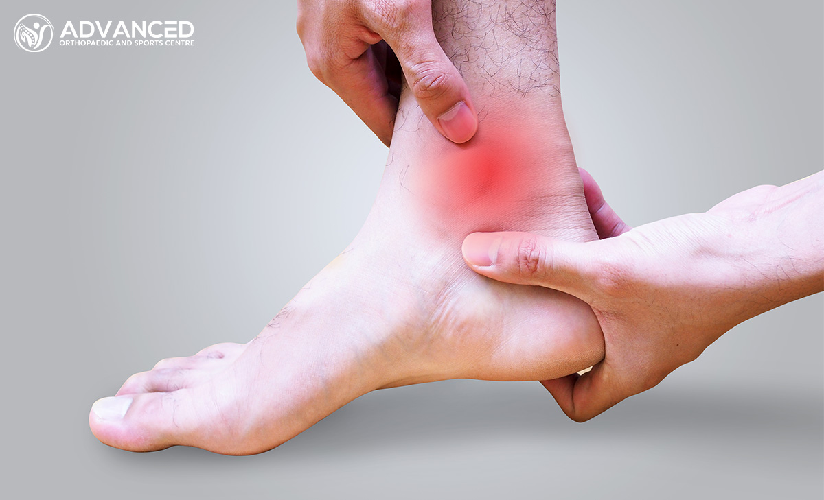 Ankle Sprains: Tips and Exercises for Injury Prevention