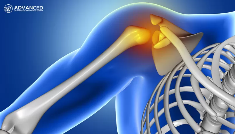 Rotator Cuff Tears Due to an Injury