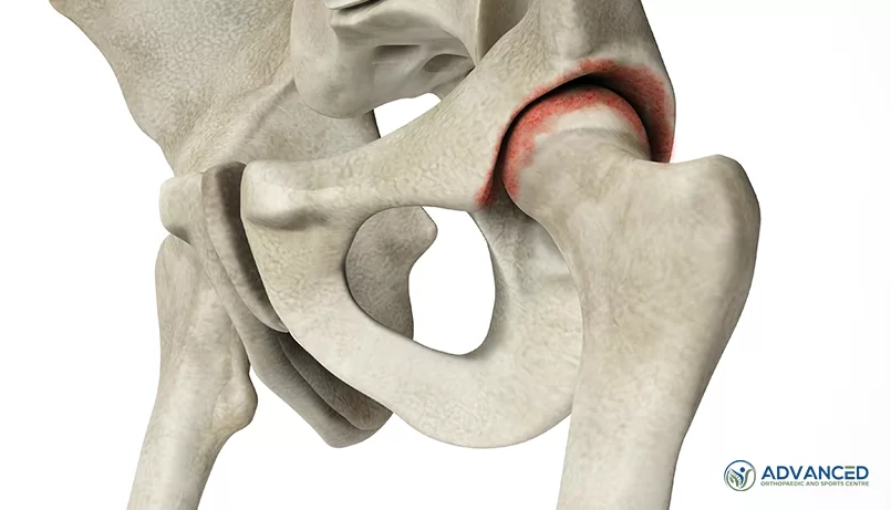 Animation showing the pain point