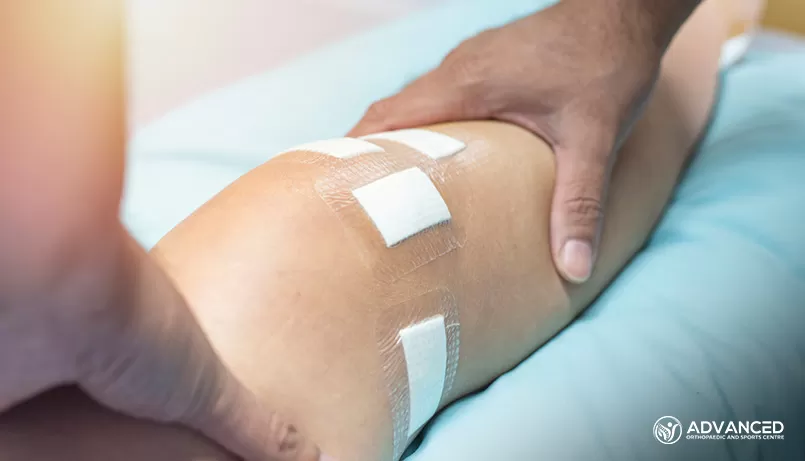 Treating an ACL injury with surgery in Singapore