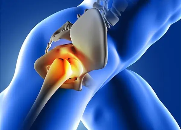 AO-hip arthro
