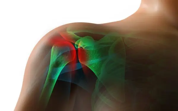 AO-rotator cuff