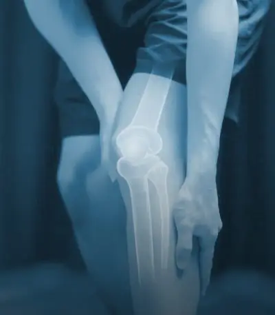 Conditions-Image-knee