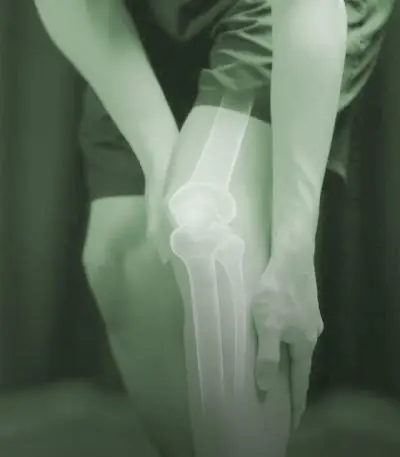 Conditions-Image-knee-green