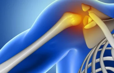 shoulder-surgery-specialist-in-singapore