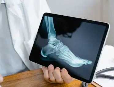 AO-foot-arthritis-diagnosis