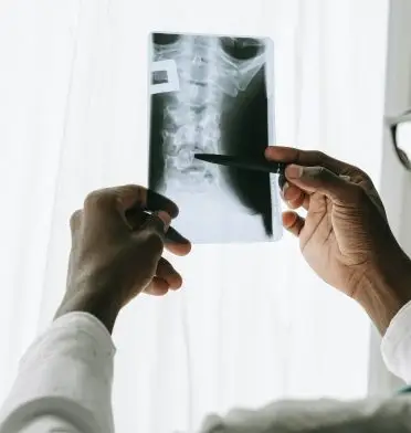 AO-cervical-spondylosis-diagnosis-m
